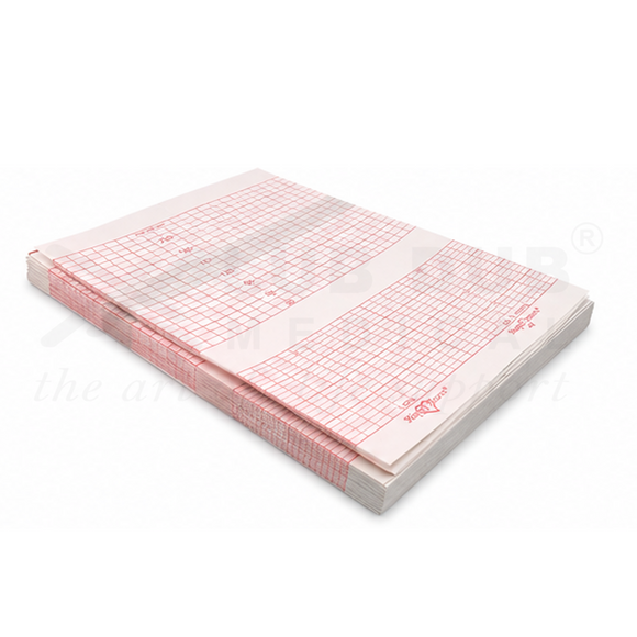 Fetal Monitoring Paper 152×90 mm | CTG Paper